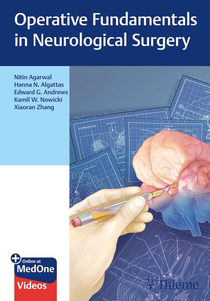 Operative Fundamentals in Neurological Surgery (Nitin Agarwal)