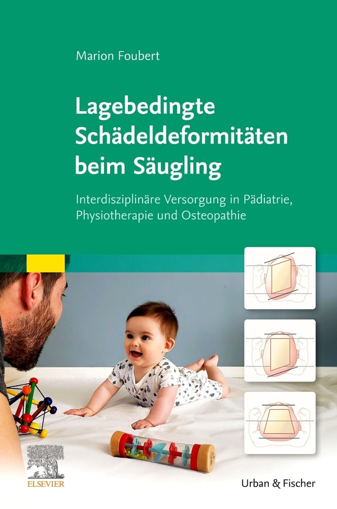 Lagebedingte Schädeldeformitäten beim Säugling (Marion Foubert)