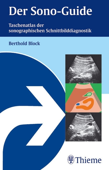 Der Sono-Guide (Berthold Block)