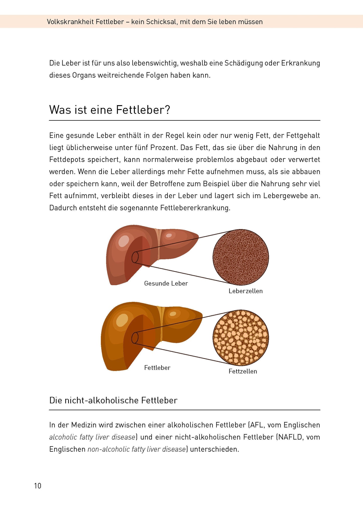Die Haferkur gegen Fettleber