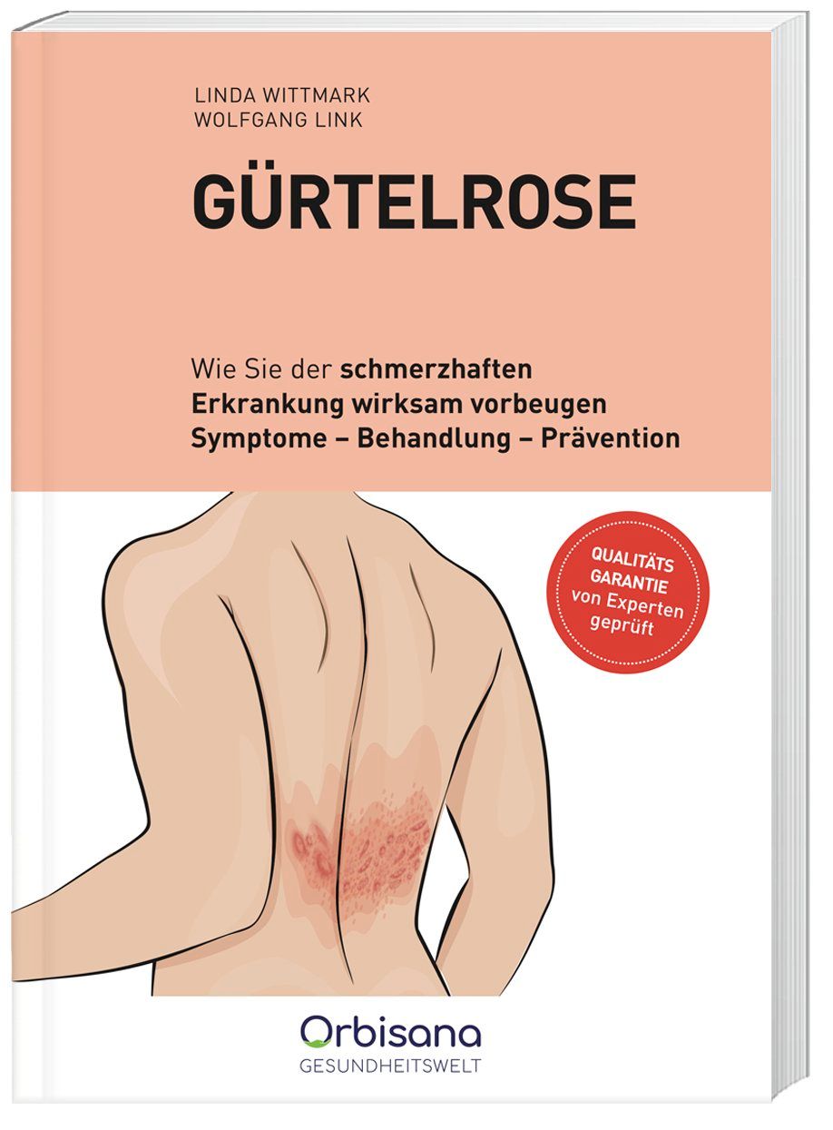 Gürtelrose Orbisana