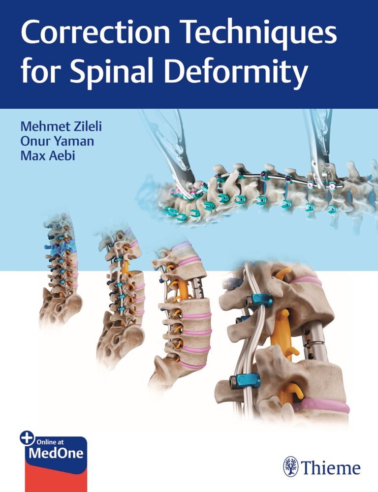 Correction Techniques for Spinal Deformity (Mehmet Zileli)