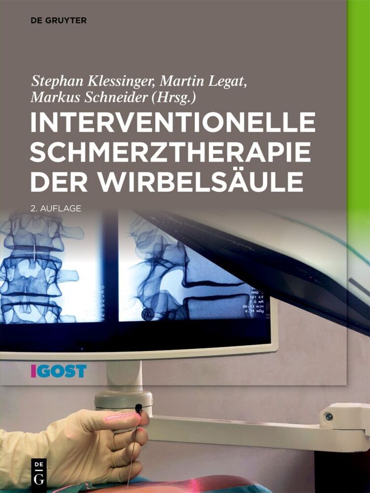 Interventionelle Schmerztherapie der Wirbelsäule (Stephan Klessinger)