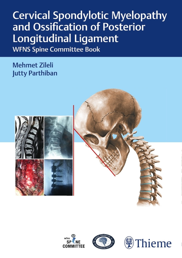 Cervical Spondylotic Myelopathy and Ossification of Posterior Longitudinal Ligament (Mehmet Zileli)