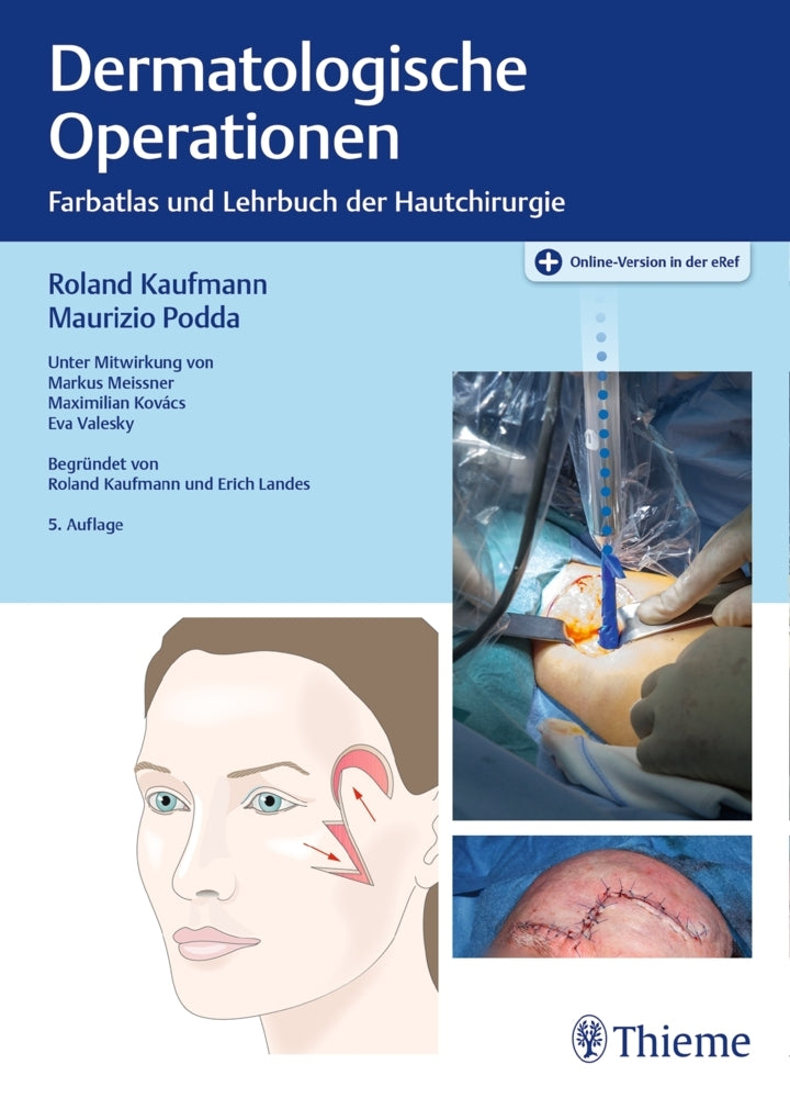 Dermatologische Operationen (Roland Kaufmann)