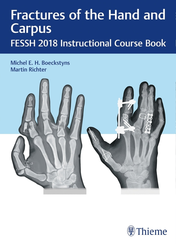 Fractures of the Hand and Carpus (Michel E.H. Boeckstyns)