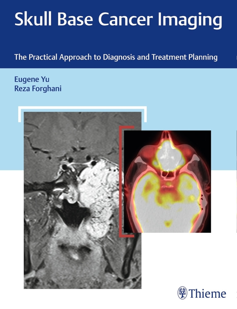 Skull Base Cancer Imaging (Eugene Yu)