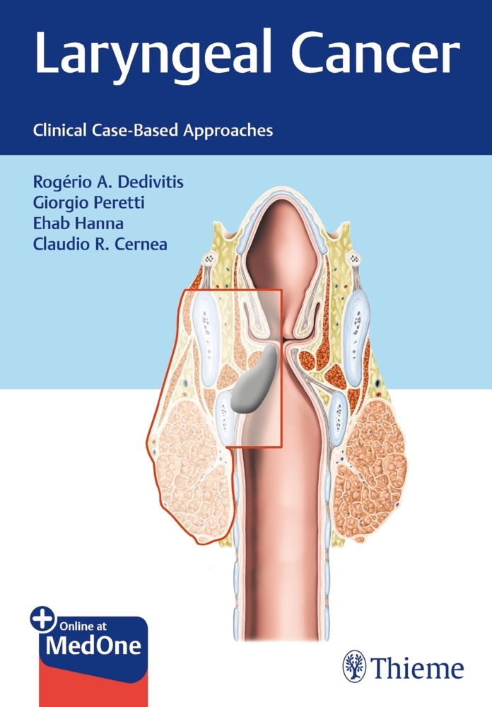 Laryngeal Cancer (Rogério A. Dedivitis)