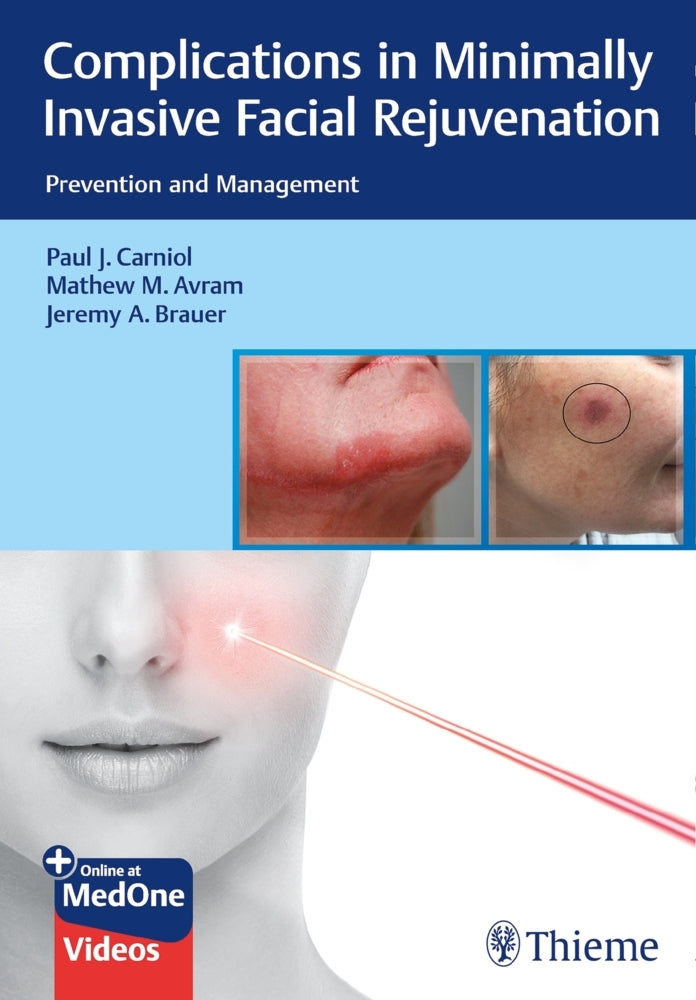 Complications in Minimally Invasive Facial Rejuvenation (Paul J. Carniol)