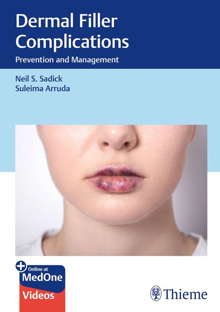 Dermal Filler Complications (Neil S. Sadick)