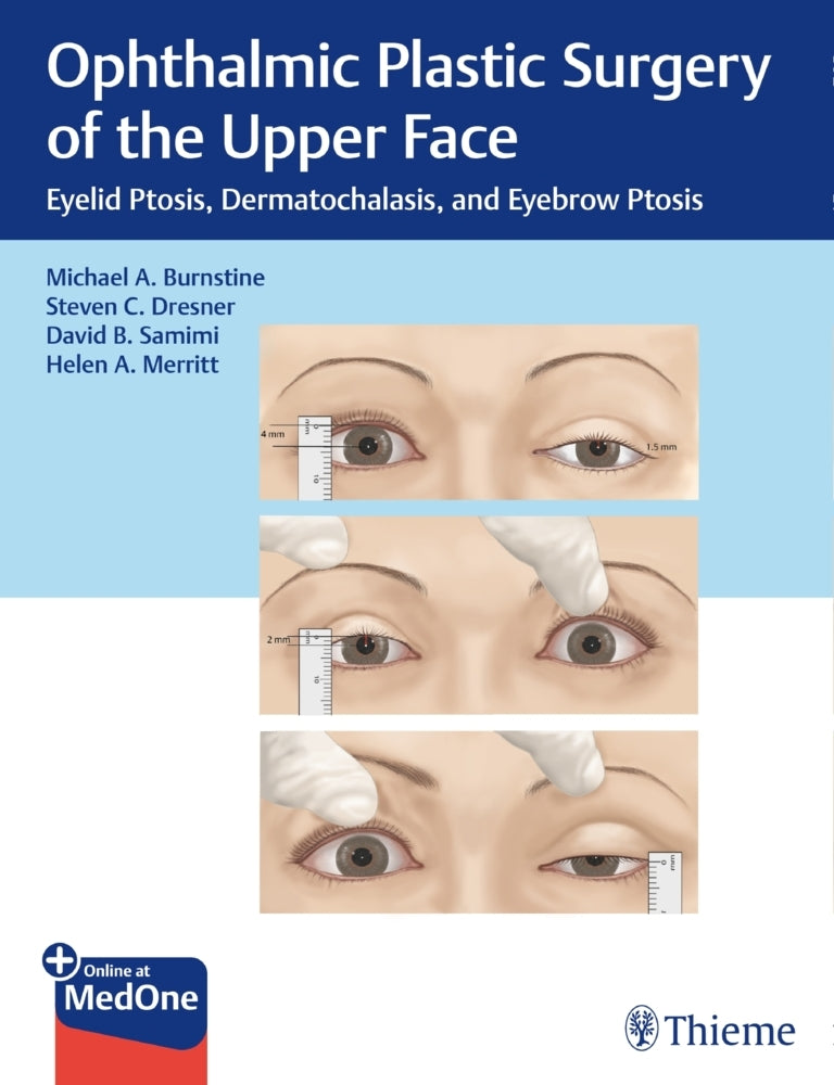 Ophthalmic Plastic Surgery of the Upper Face (Michael A. Burnstine)