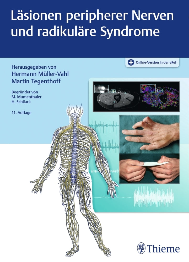 Läsionen peripherer Nerven und radikuläre Syndrome (Hermann Müller-Vahl)