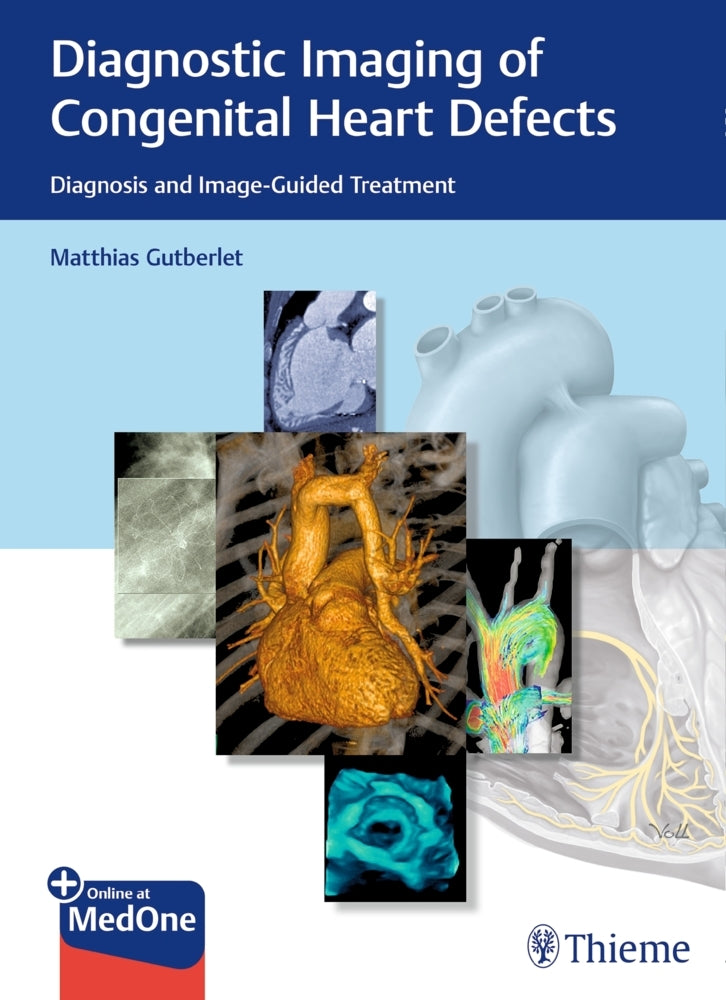 Diagnostic Imaging of Congenital Heart Defects (Matthias Gutberlet)