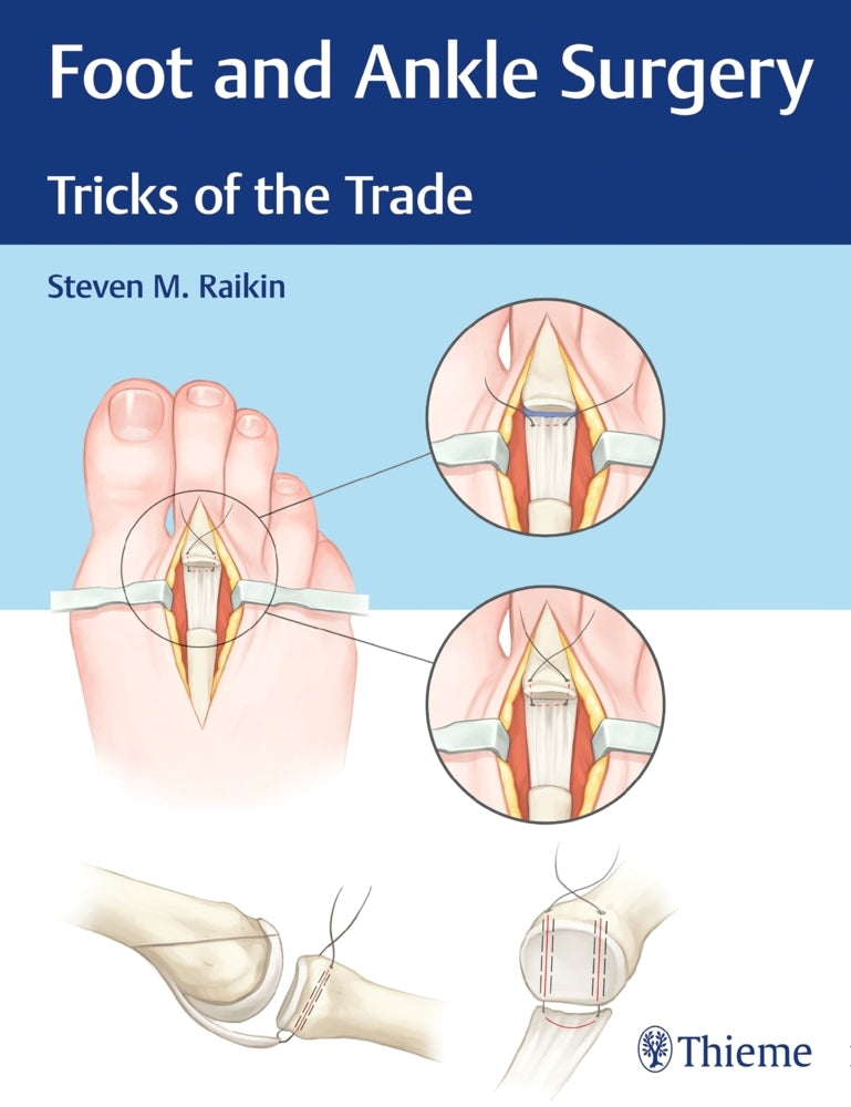 Foot and Ankle Surgery (Steven M. Raikin)