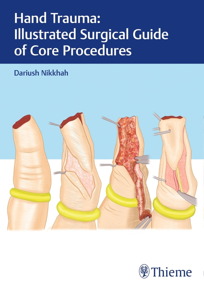 Hand Trauma: Illustrated Surgical Guide of Core Procedures (Dariush Nikkhah)