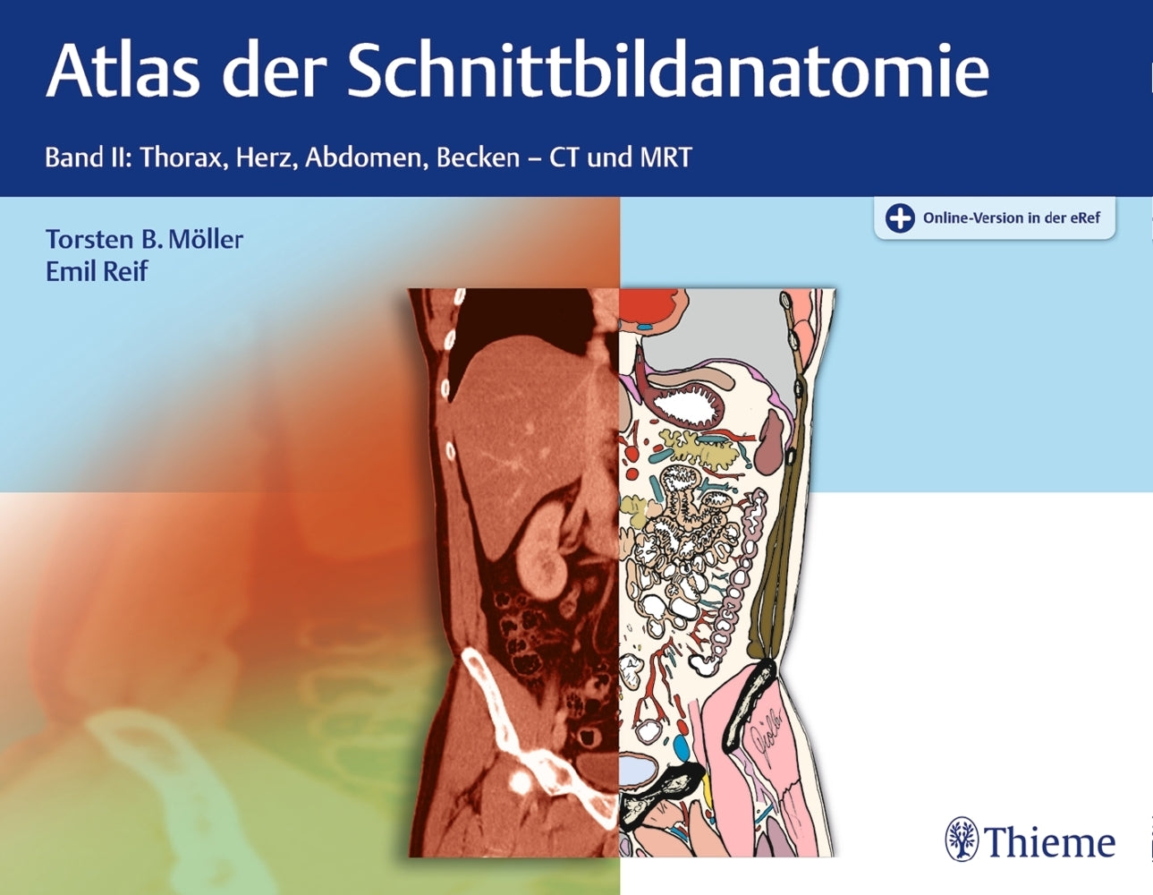 Atlas der Schnittbildanatomie.Bd.2 (Torsten B. Möller)