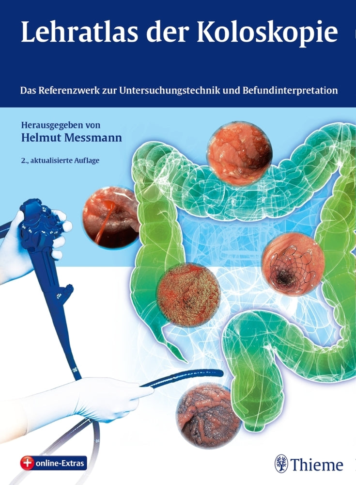 Lehratlas der Koloskopie (Helmut Messmann)