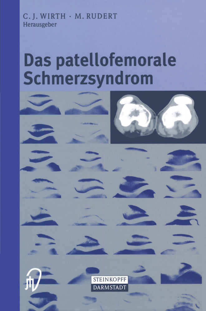 Das patellofemorale Schmerzsyndrom (C. J. Wirth)