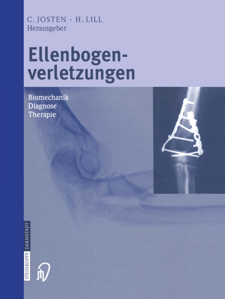 Ellenbogenverletzungen (C. Josten)