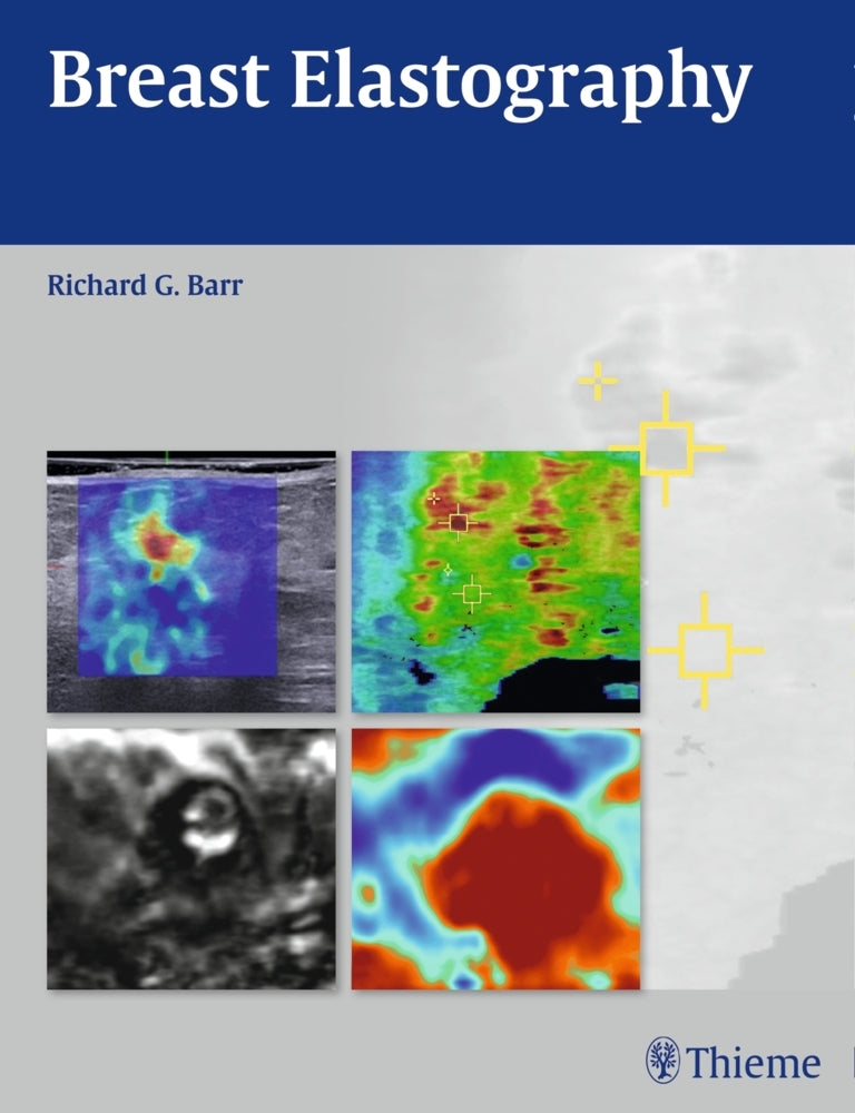 Breast Elastography (Richard G. Barr)
