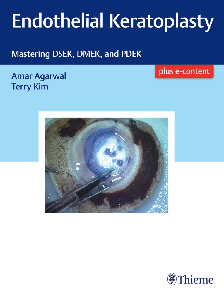 Endothelial Keratoplasty (Amar Agarwal)