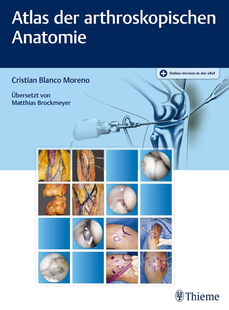 Atlas der arthroskopischen Anatomie (Cristian Blanco Moreno)