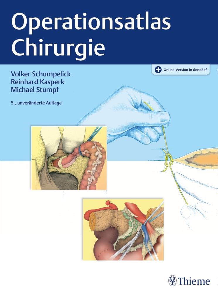 Operationsatlas Chirurgie (Volker Schumpelick)