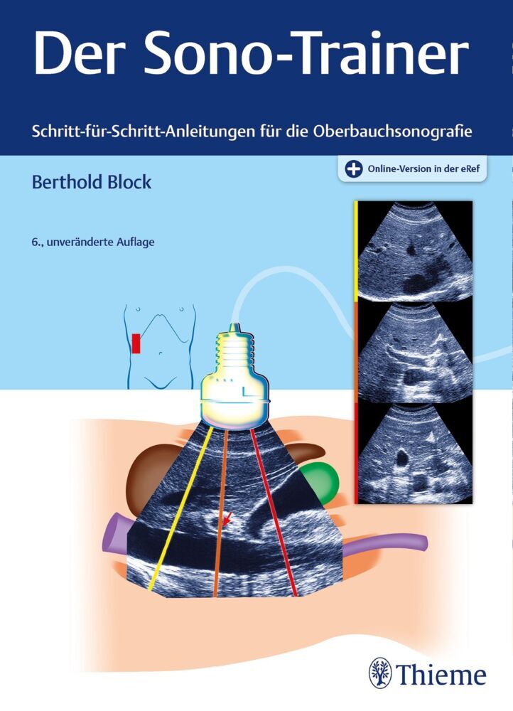 Der Sono-Trainer (Berthold Block)