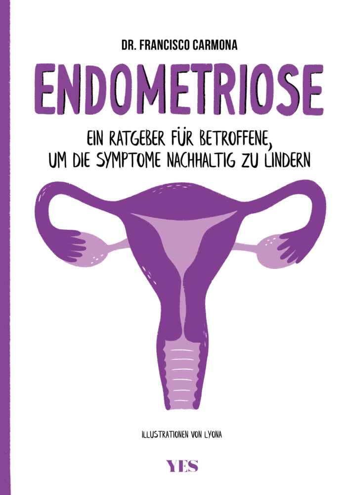 Endometriose (Francisco Carmona)