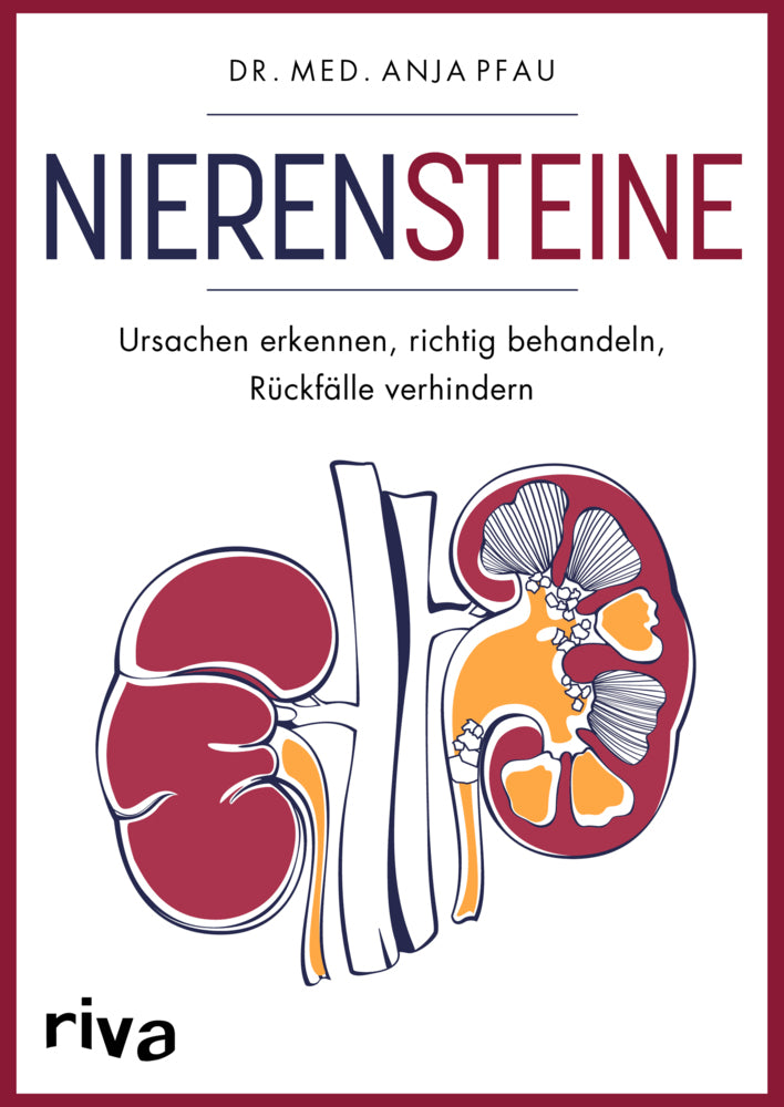 Nierensteine - Ursachen erkennen, richtig behandeln, Rückfälle verhindern (Anja Pfau)