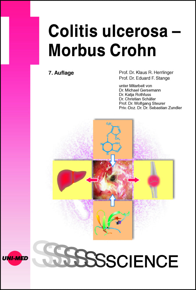 Colitis ulcerosa - Morbus Crohn (Klaus R. Herrlinger)
