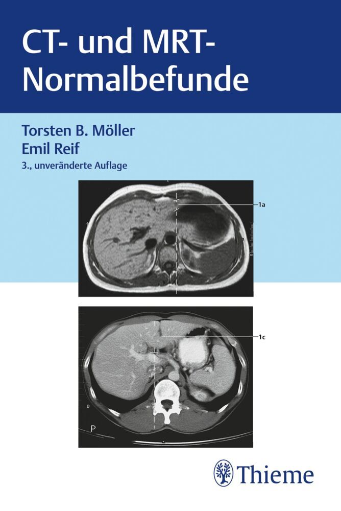 CT und MRT Normalbefunde (Torsten Bert Möller)