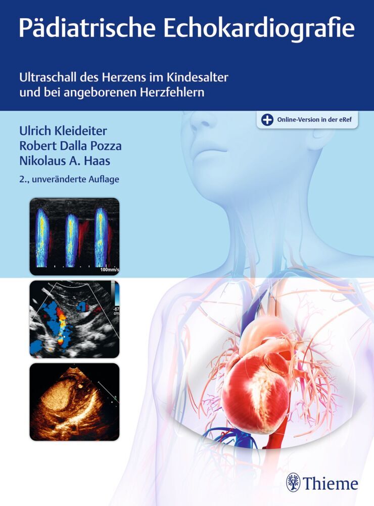 Pädiatrische Echokardiografie (Ulrich Kleideiter)