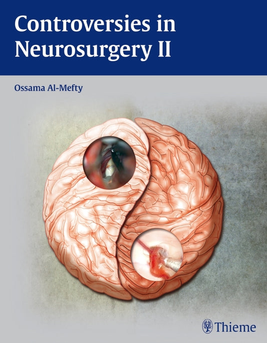 Controversies in Neurosurgery II..Vol.2 (Ossama Al- Mefty)