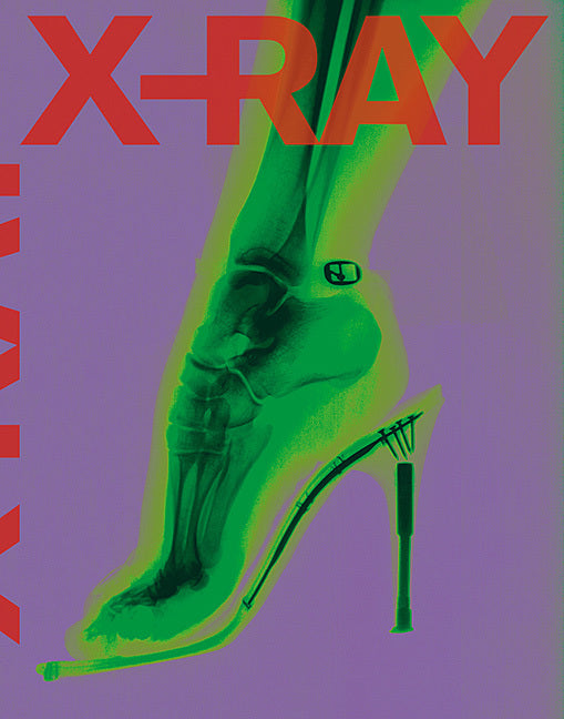 X-Ray (Weltkulturerbe Völklinger Hütte)