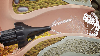 Wush Elektrischer Ohrenreiniger