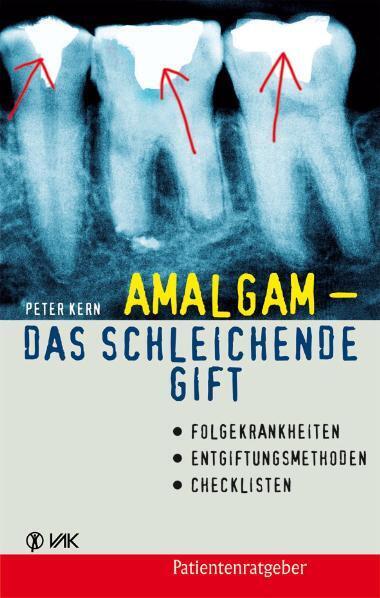 Amalgam - das schleichende Gift (Peter Kern)