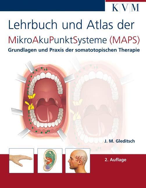 Lehrbuch und Atlas der Mikroakupunktsysteme (MAPS) (Jochen M. Gleditsch)