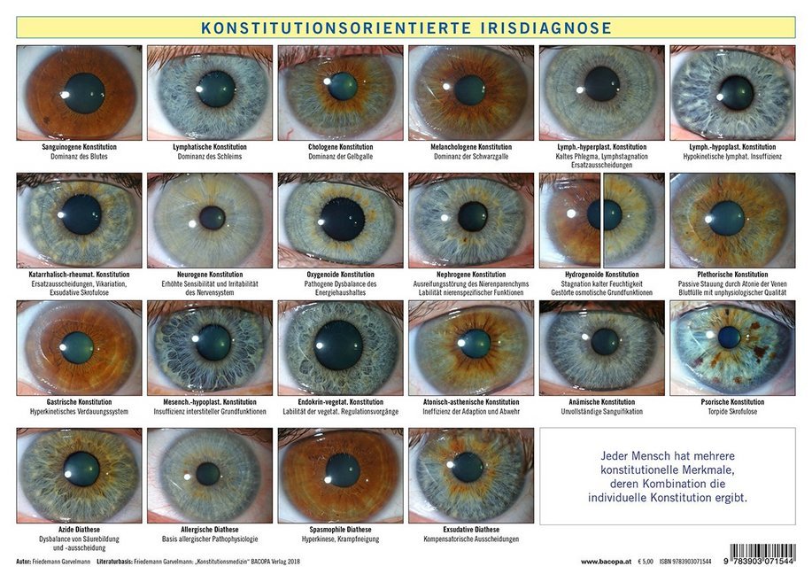 Konstitutionsorientierte Irisdiagnose, Tafel (Friedemann Garvelmann)