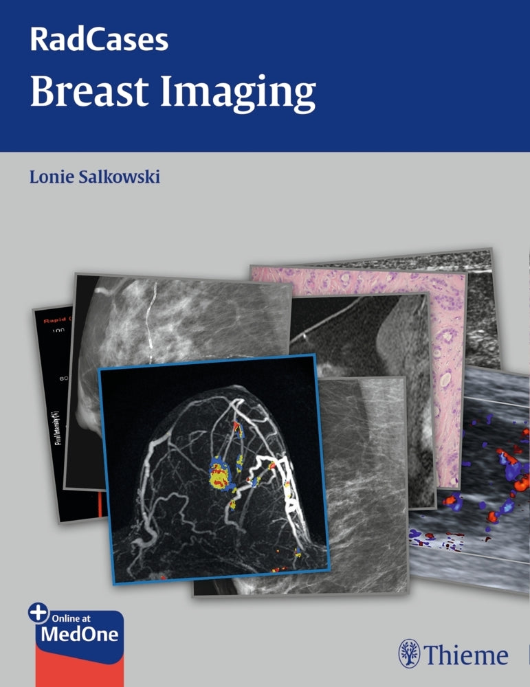 Radcases Breast Imaging (Lonie L. Salkowski)