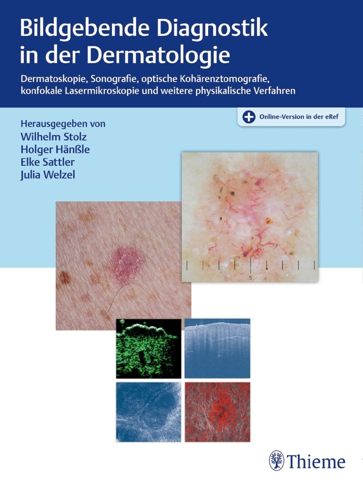 Bildgebende Diagnostik in der Dermatologie (Wilhelm Stolz)