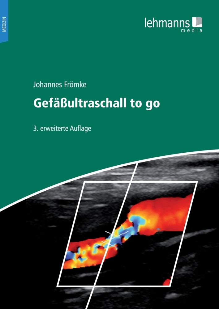 Gefäßultraschall to go (Johnnes Frömke)