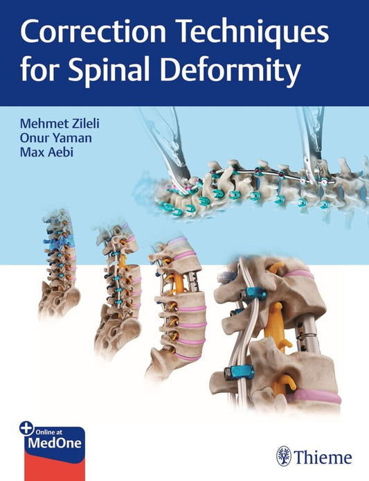Correction Techniques for Spinal Deformity (Mehmet Zileli)