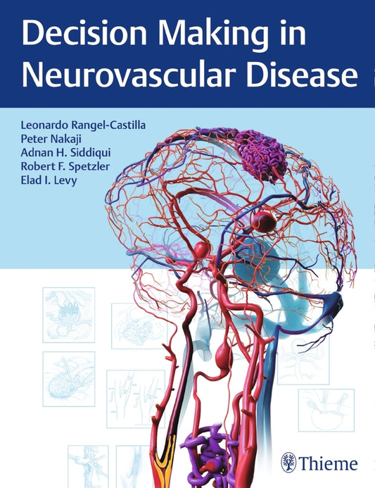 Decision Making in Neurovascular Disease (Adnan H. Siddiqui)
