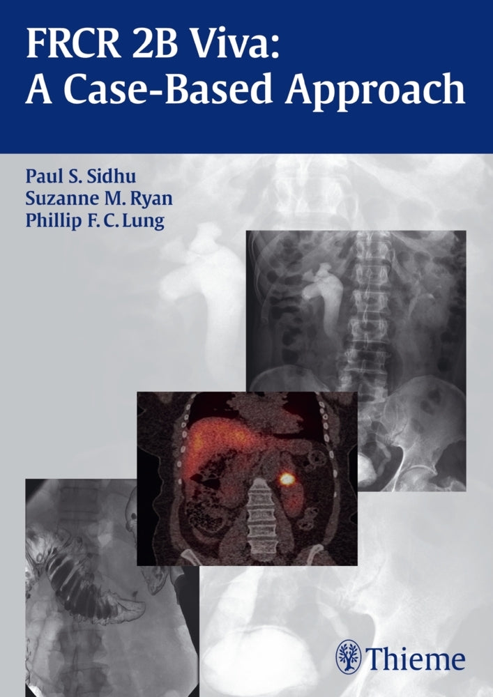 FRCR 2B Viva: A Case-based Approach (Paul S. Sidhu)