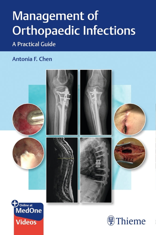 Management of Orthopaedic Infections (Antonia Chen)