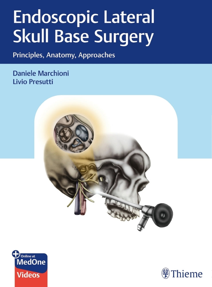 Endoscopic Lateral Skull Base Surgery (Daniele Marchioni)