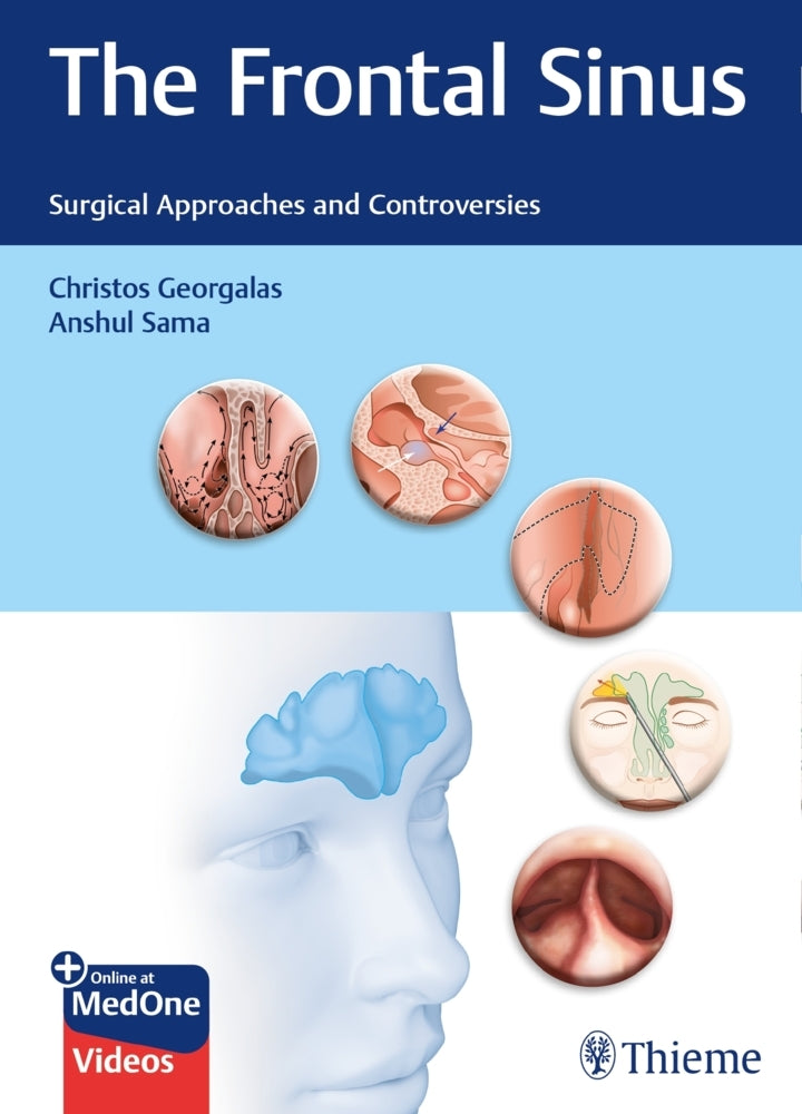 The Frontal Sinus (Christos Georgalas)
