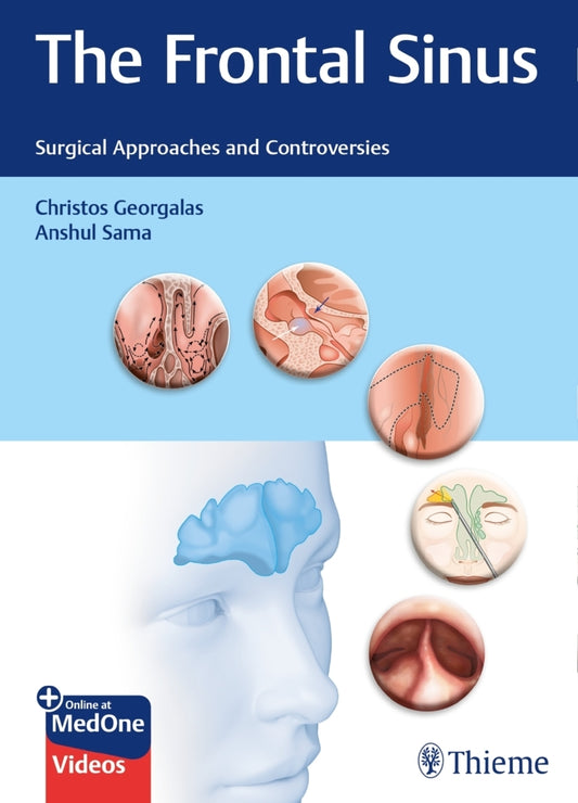 The Frontal Sinus (Christos Georgalas)