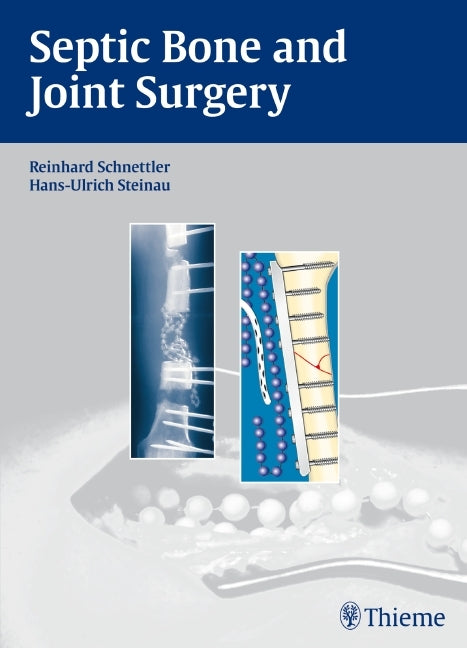 Septic Bone and Joint Surgery (Reinhard Schnettler)